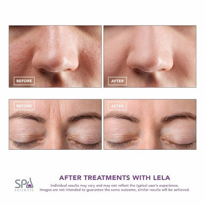 Spa Sciences LELA Ultrasonic Skin Scrubber Spatula Pink - Imperfect Box