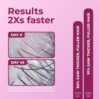 BosleyMD Revive + Densifying Hair Regrowth Serum for Women 1 fl oz - Missing Box